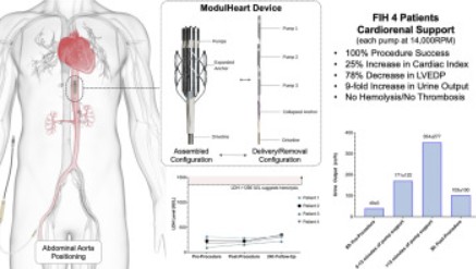 Dispositif médical innovant développé par l'entreprise Puzzle Dispositifs Médicaux pour le traitement de l'insuffisance cardiaque avancée.